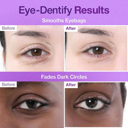 Numbuzin N09 NAD + Collagen Under Eye Patcjes 5EA